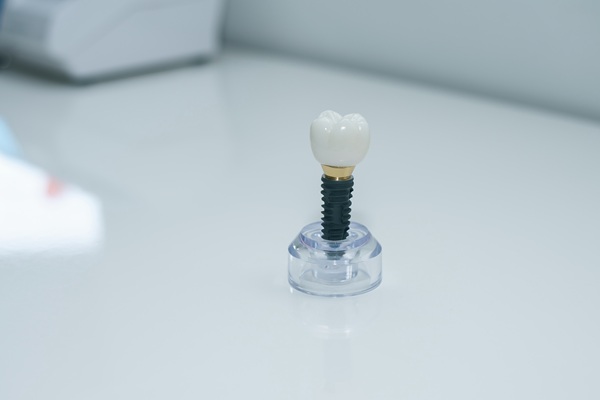 Understanding The Procedure For Dental Implants