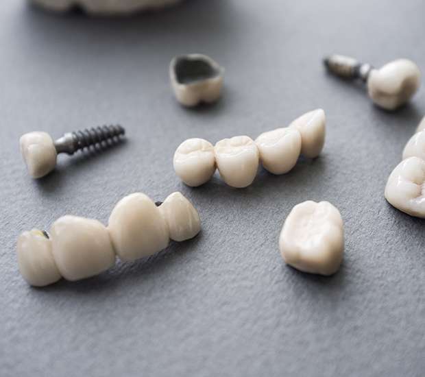 Belleville The Difference Between Dental Implants and Mini Dental Implants
